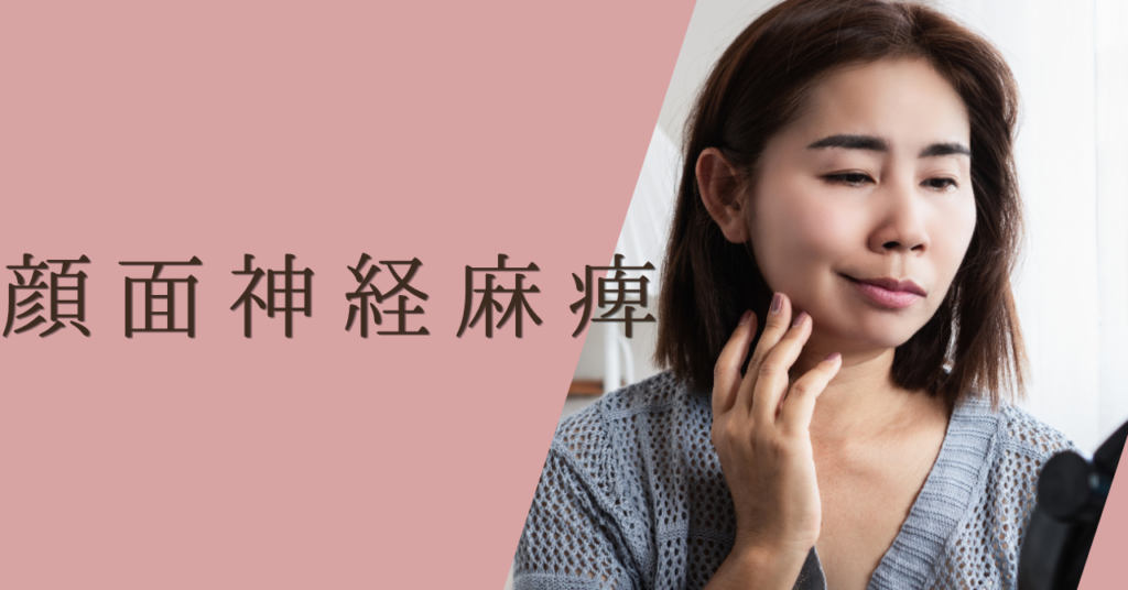 顔面神経麻痺